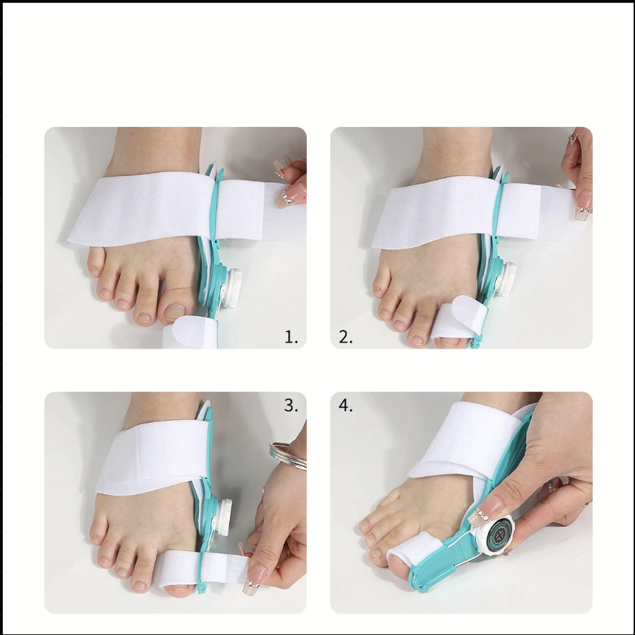 ‌Correcteur d'Hallux valgus jour/nuit