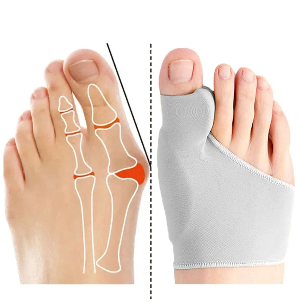 Protection et correcteur d'Hallux valgus (1 paire)